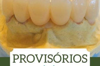 Provisórios